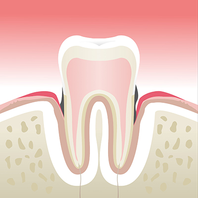 Parodontologie Lyon