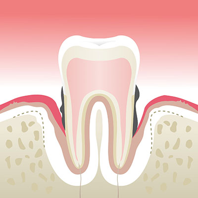 Parodontologie Lyon